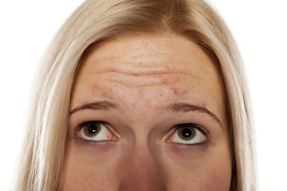 8 tips that might help prevent acne and breakouts?