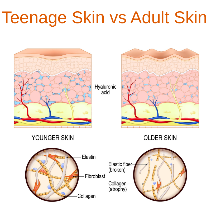 Why Teen Skin is Different and Why It Matters