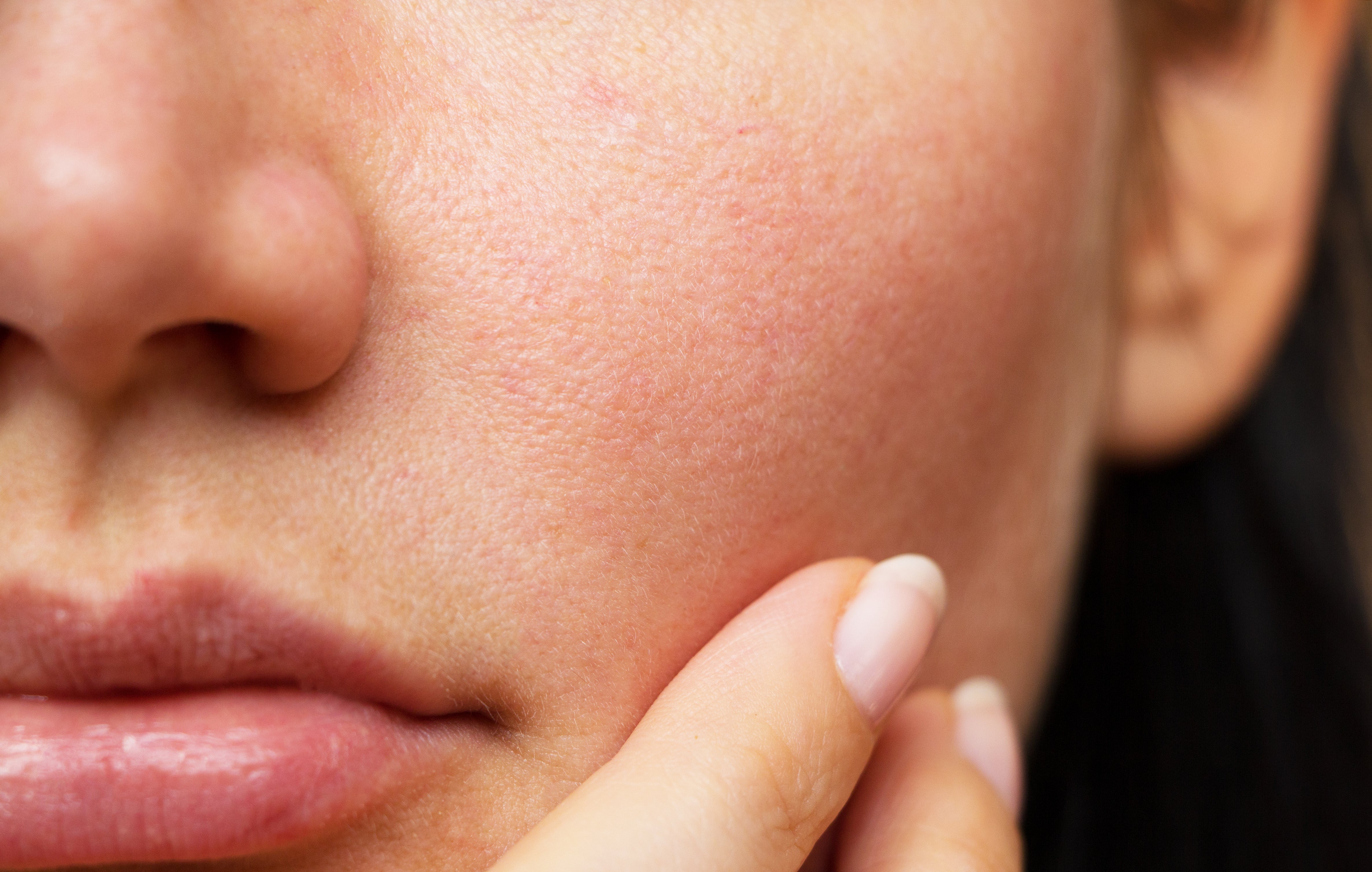 Best cosmetic ingredients for teenage skin care